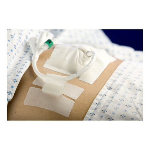 M.C. Johnson, Cath-Secure, 1 Each